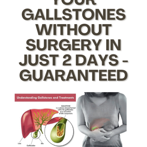 Get Out Your Gallstones Without Surgery In 2 Days - Guaranteed