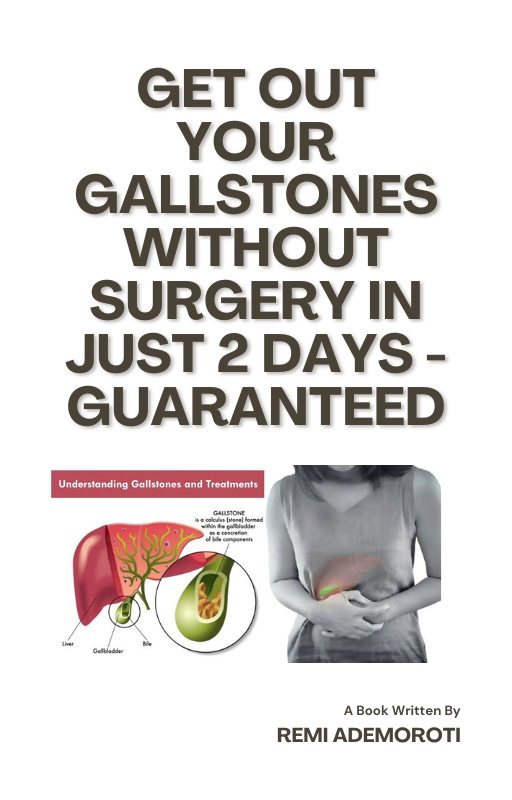 Get Out Your Gallstones Without Surgery In 2 Days - Guaranteed